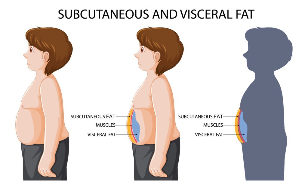 "Visual representation of subcutaneous visceral fat in the human body."