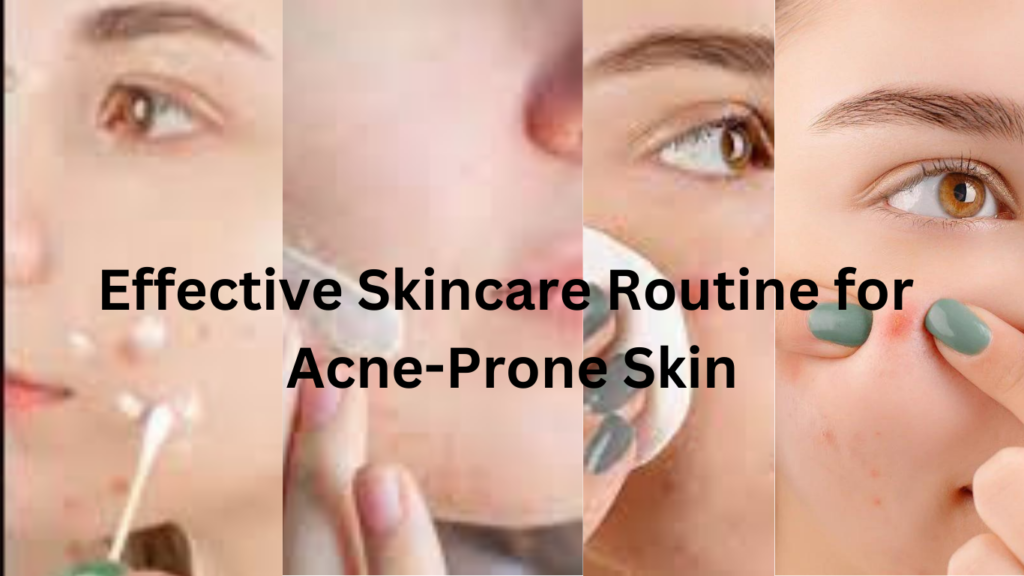 A girl demonstrating an effective skincare routine for acne-prone skin, including cleansing, toning, moisturizing, and applying sunscreen.