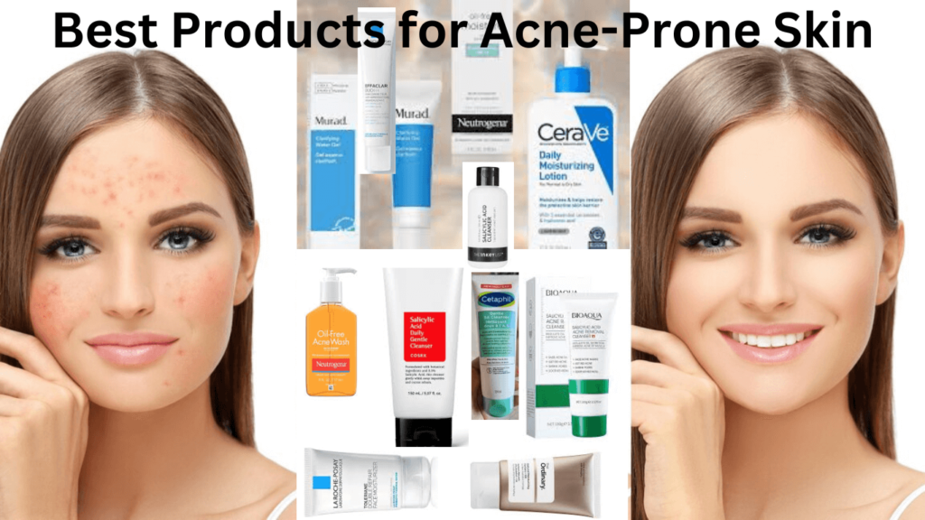 A woman with acne-prone skin in a before and after comparison, showing significant improvement after using recommended skincare products.