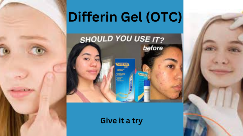 Differin Gel for an effective skincare routine for acne-prone skin, displayed with its packaging.