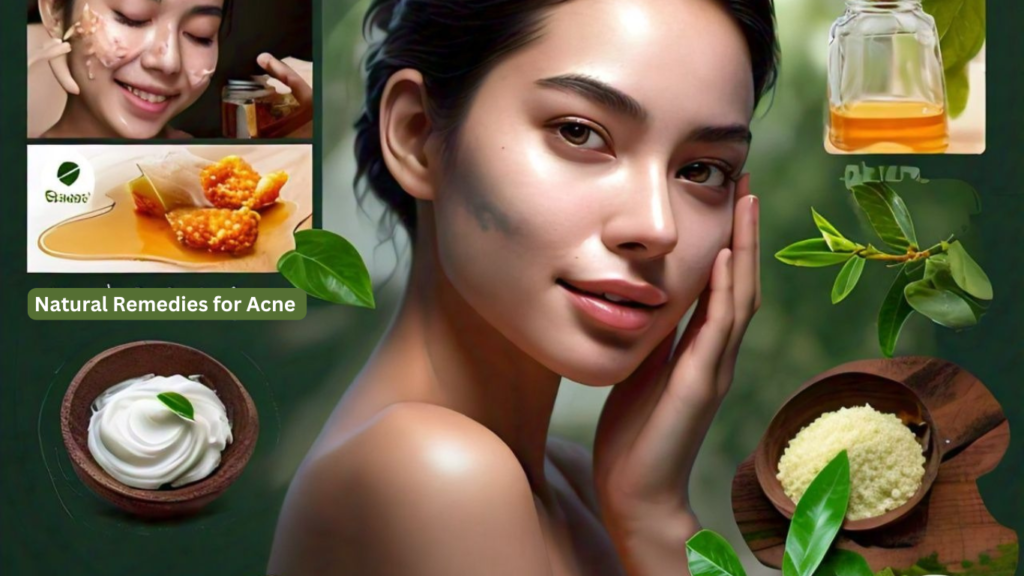 A girl with clear, beautiful skin surrounded by icons representing natural remedies such as aloe vera, tea tree oil, and honey.